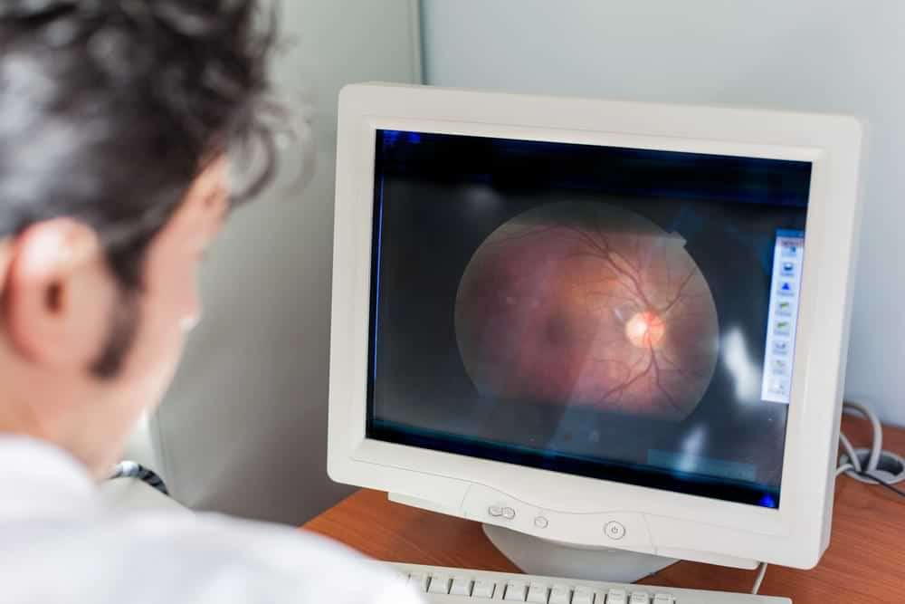 retinal scan myopia axial elongation