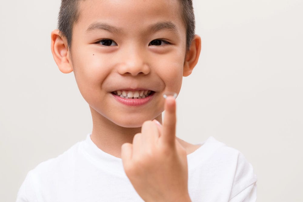 misight contact lenses sydney
